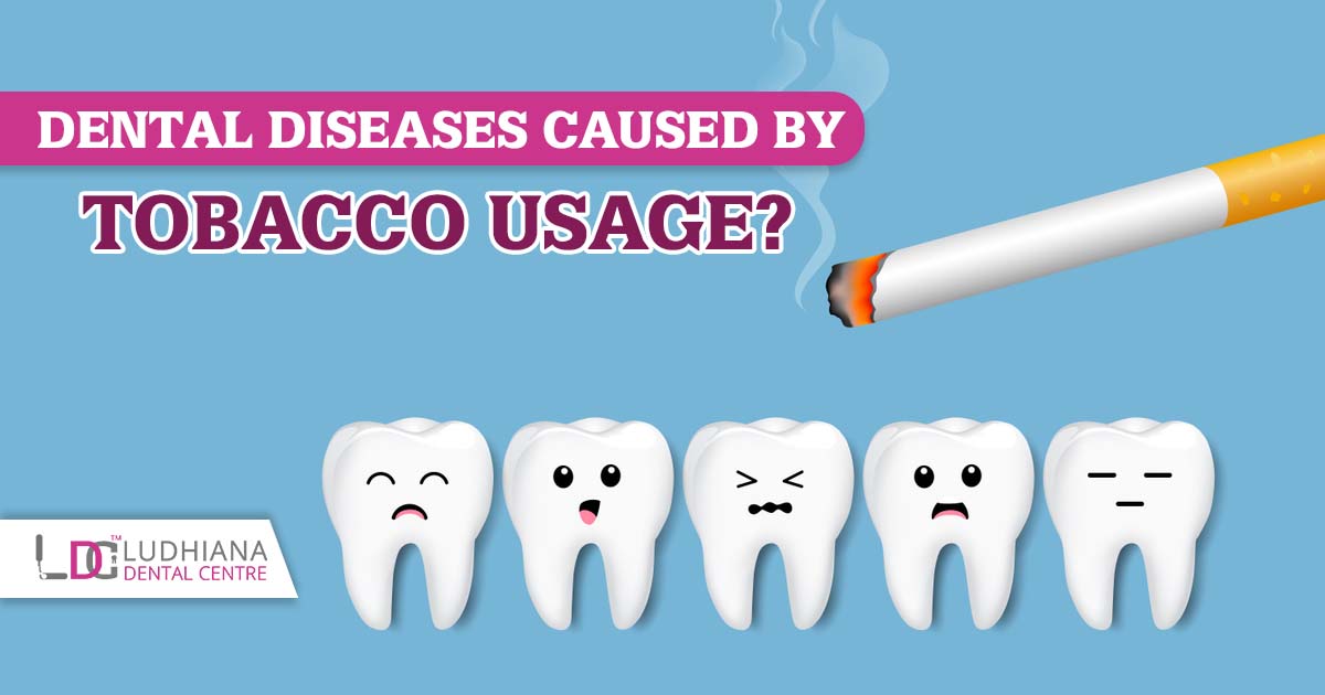 Dental diseases caused by tobacco usage?