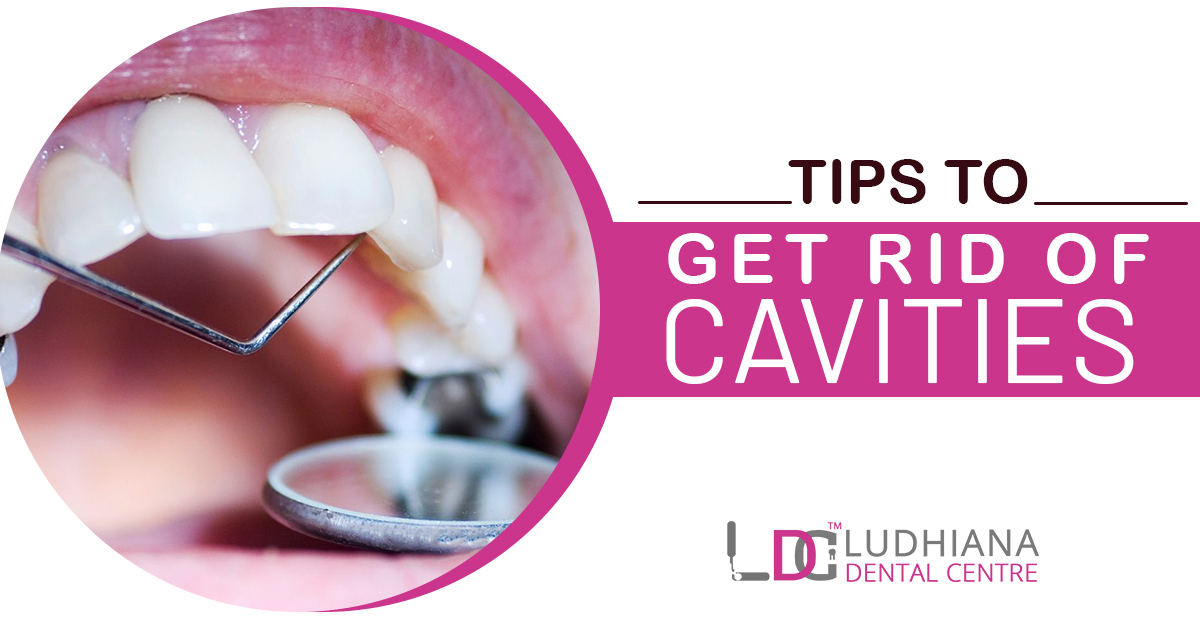 Tips to Get Rid of Cavities