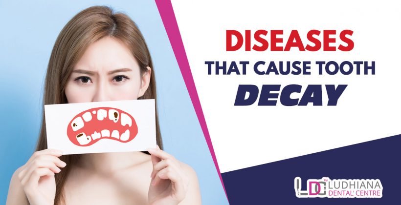Diseases that cause tooth decay