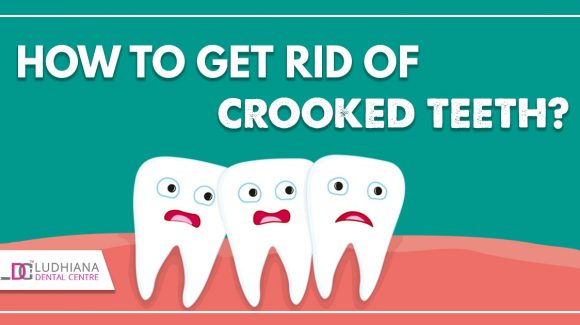 How to get Rid of Crooked Teeth?