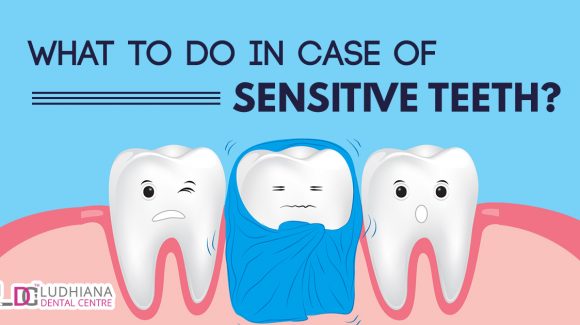 What to do in case of sensitive teeth?