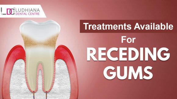 Treatments available for receding gums