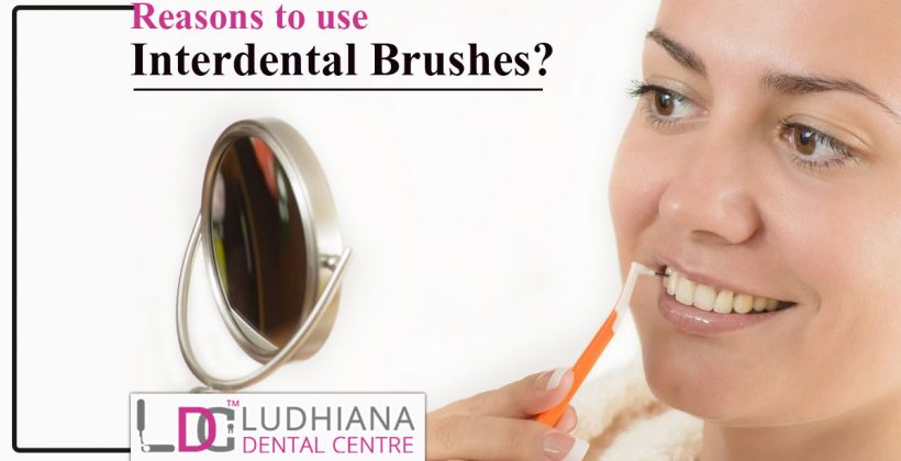 Reasons to use interdental brushes?