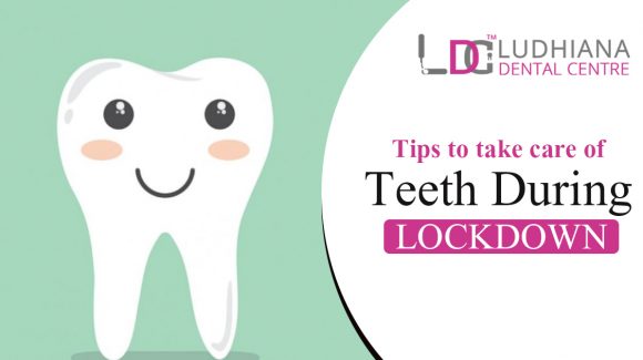 Tips to take care of teeth during lockdown