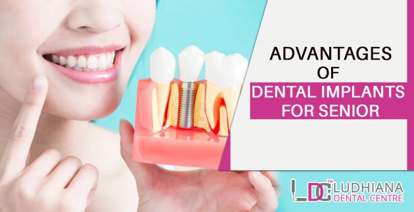 Advantages of Dental Implants for Senior