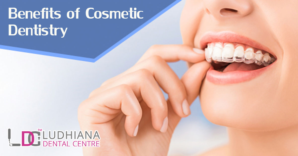 Enhancing Smile And Boosting Confidence Through Cosmetic Dentistry