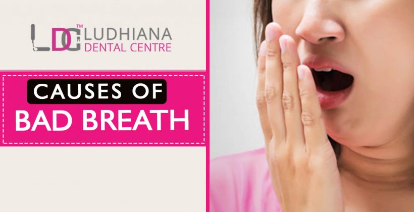 Causes of Bad Breath