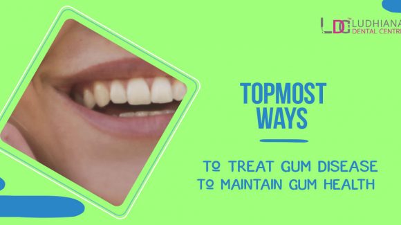 What are the topmost ways to treat gum disease to maintain gum health?