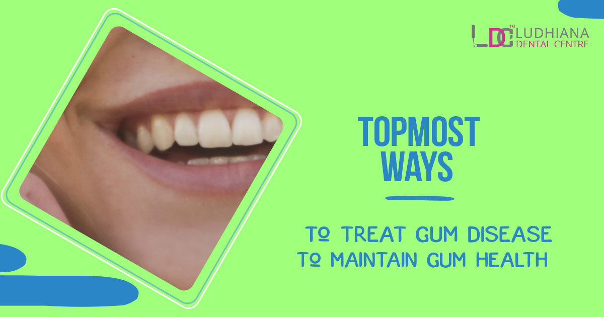 What are the topmost ways to treat gum disease to maintain gum health?