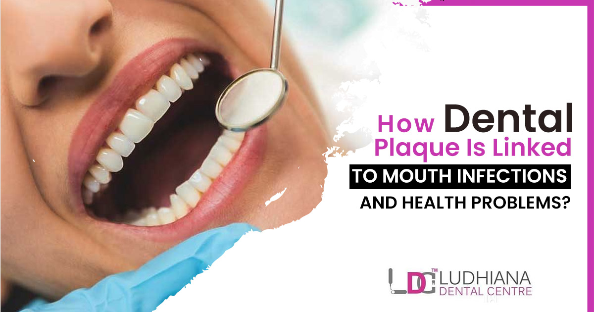 How dental plaque is linked to mouth infections and health problems?