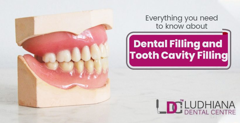 Everything you need to know about Dental filling and tooth cavity filling