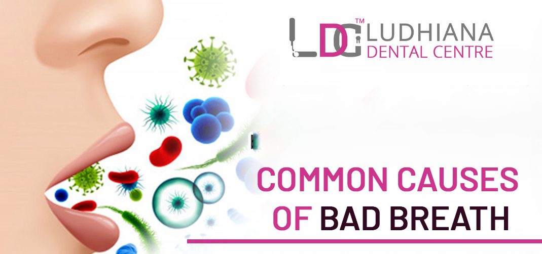 What are the top reasons to follow the dental care regime for bad breath?