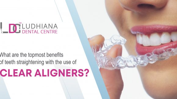 What are the topmost benefits of teeth straightening with the use of clear aligners?