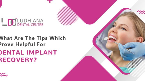 What are the tips which prove helpful for dental implant recovery?