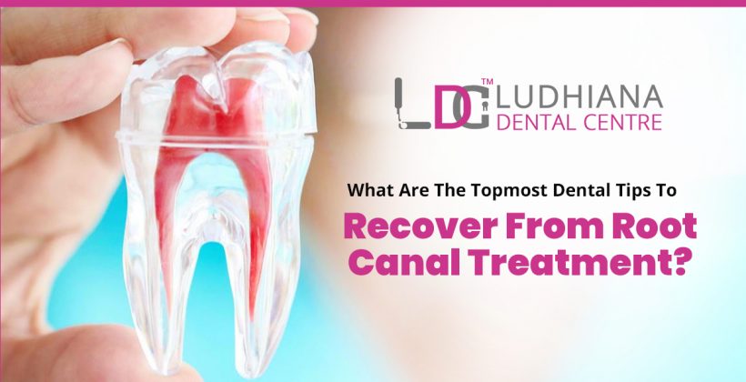 What are the topmost dental tips to recover from root canal treatment?