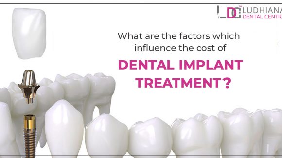 What are the factors which influence the cost of dental implant treatment?