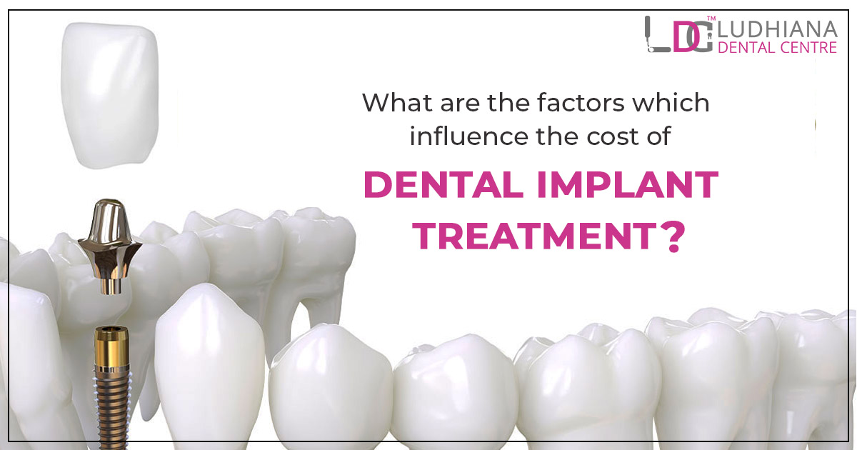 What are the factors which influence the cost of dental implant treatment?