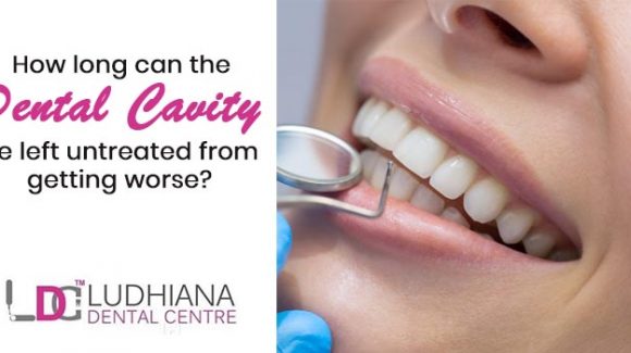 How long can the dental cavity be left untreated from getting worse?