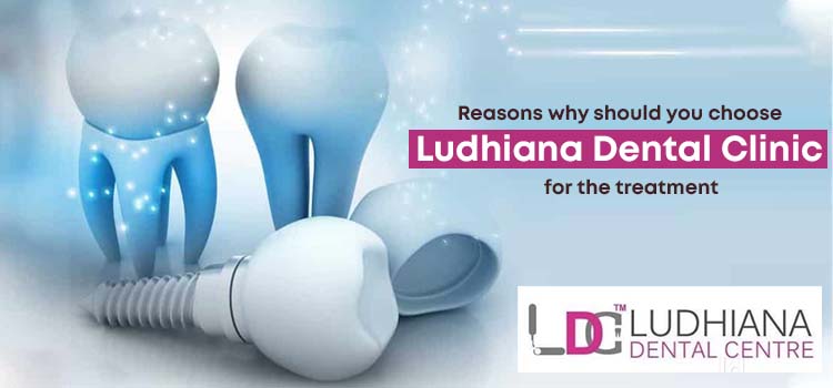 Reasons why should you choose Ludhiana Dental Clinic for the treatment