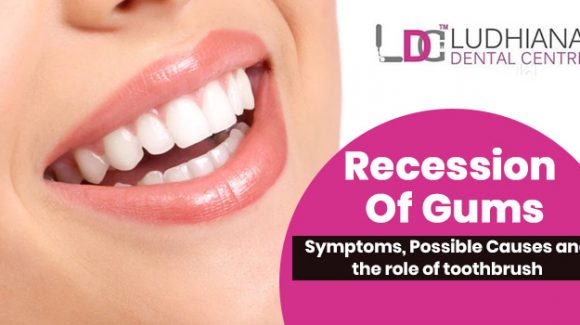 Recession of gums – Symptoms, Possible Causes and the role of toothbrush