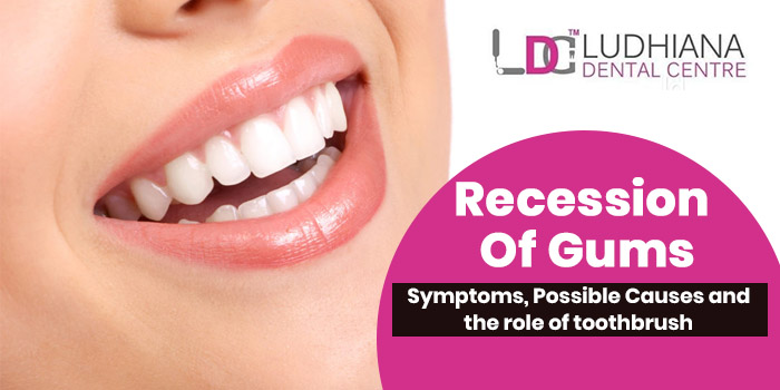 Recession of gums – Symptoms, Possible Causes and the role of toothbrush
