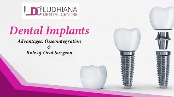 Dental implants – Advantages, Osseointegration & Role of Oral Surgeon