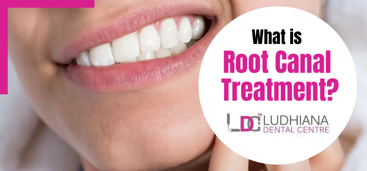 How is root canal treatment carried out? When do you need it?