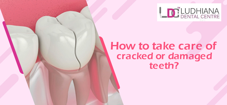 Dentist tips to take care of damaged, cracked, or painful teeth