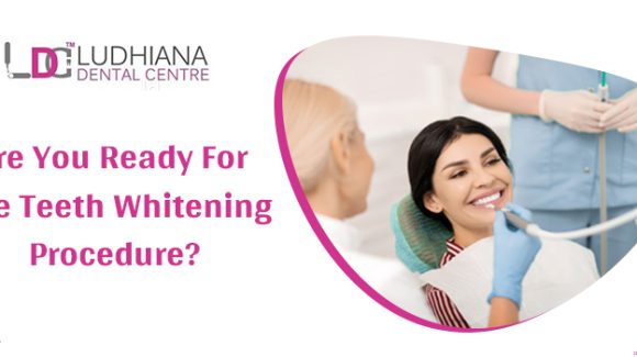 Teeth Whitening Procedure Available For The Right Candidate