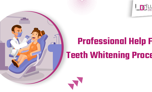 Why Should You Opt For A Dentist To Perform Teeth Whitening Process?