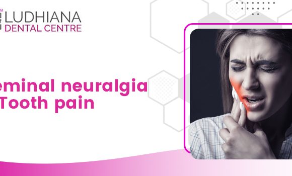 What is the relation between trigeminal neuralgia and severe tooth pain?