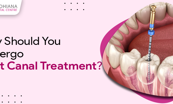 Save Your Natural Tooth With Root Canal Therapy With Our Services