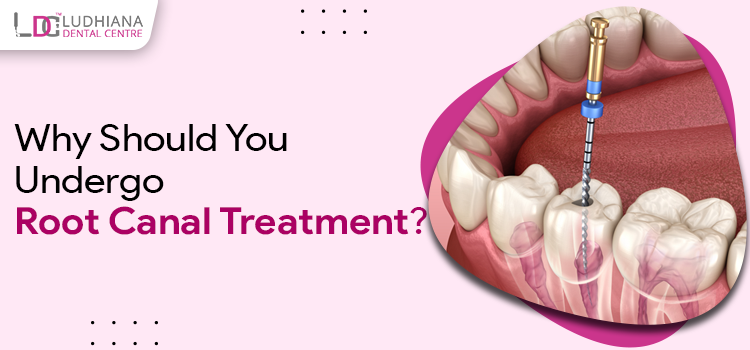 Save Your Natural Tooth With Root Canal Therapy With Our Services