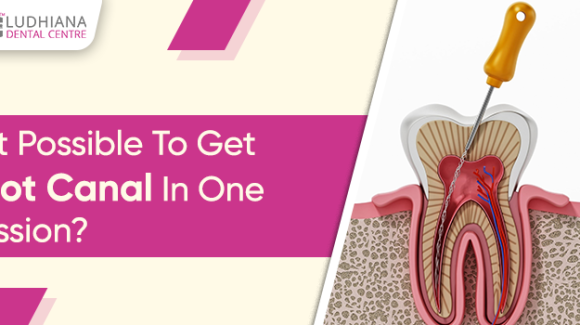 Can I undergo the root canal treatment with just one session?