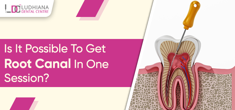 Can I undergo the root canal treatment with just one session?