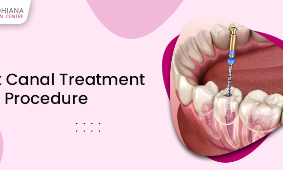 What Is Root Canal Treatment And How Does The Dentist Conduct It?