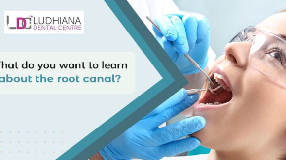 Some important factors that you should know about root canal