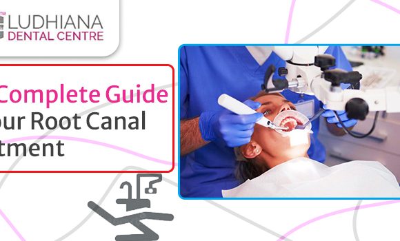 Everything You Need to Know About Treatment of your Root Canal