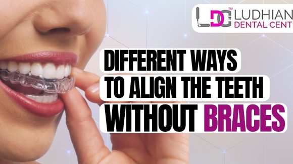 What are the reasons for the incorrect alignment of teeth?