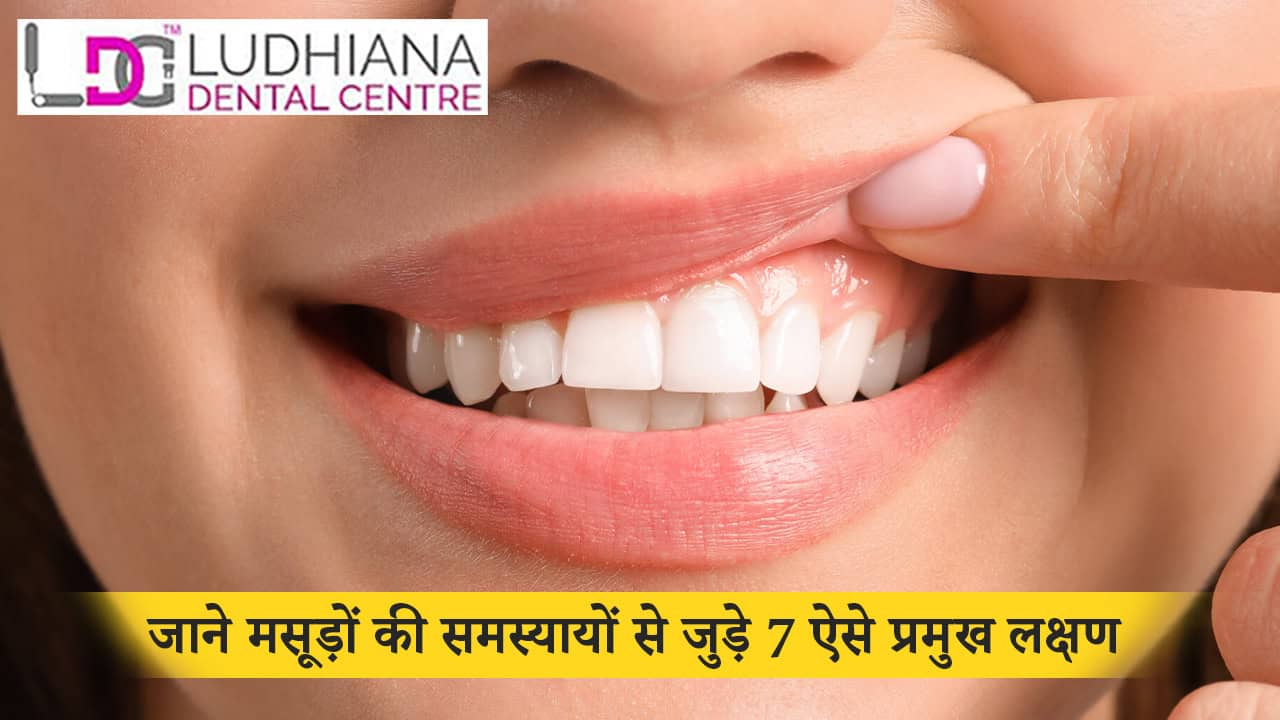 जाने मसूड़ों की समस्यायों से जुडी 7 ऐसे प्रमुख लक्षण
