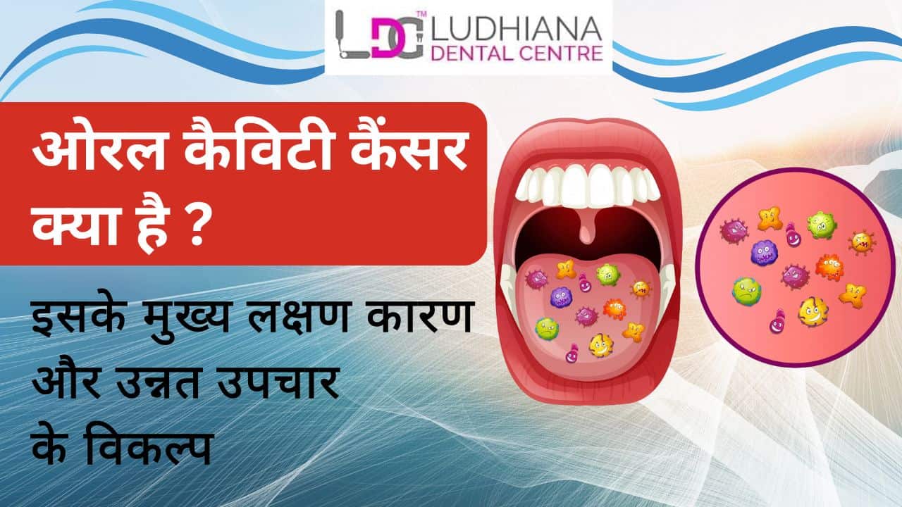 ओरल कैविटी कैंसर लक्षण, कारण और उन्नत उपचार विकल्प