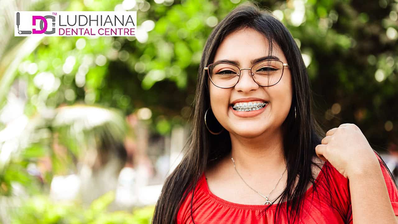 How Invisible Braces Work – Step-by-Step Alignment Process